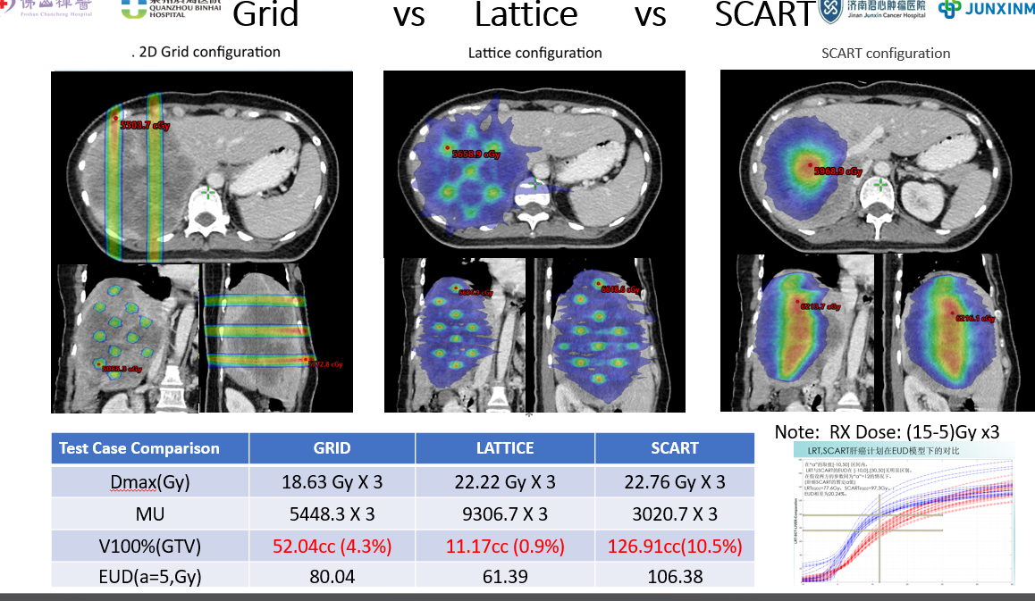 Clinical Comparison - Grid vs Lattice vs SCART