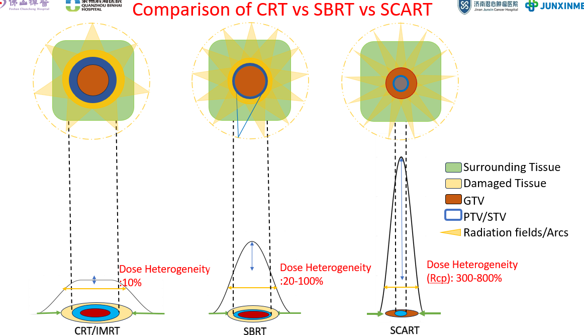 Comparison of CRT vs SBRT vs SCART